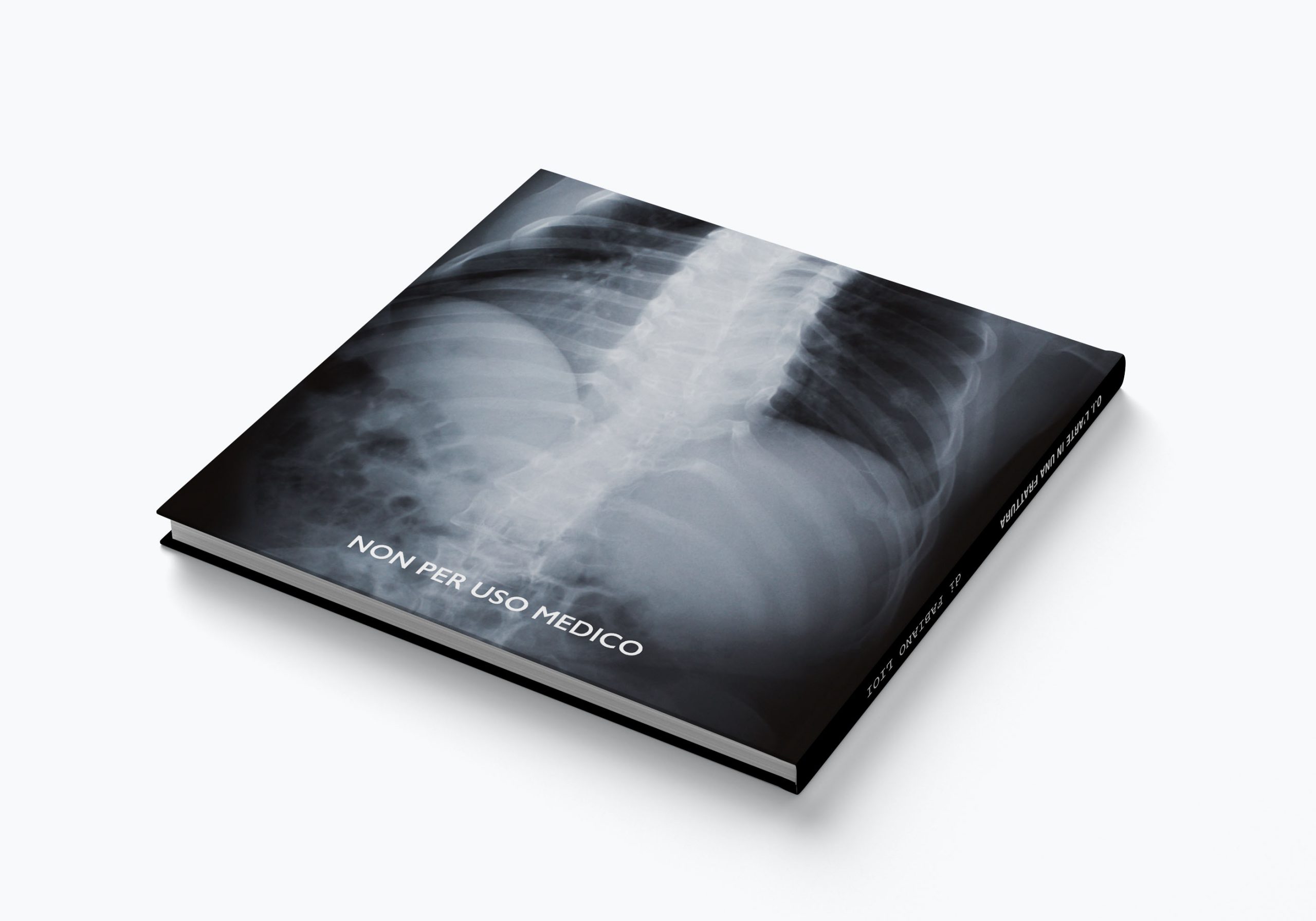O.I. L'arte in una frattura: la retrocopertina del libro sull'osteogenesi imperfetta