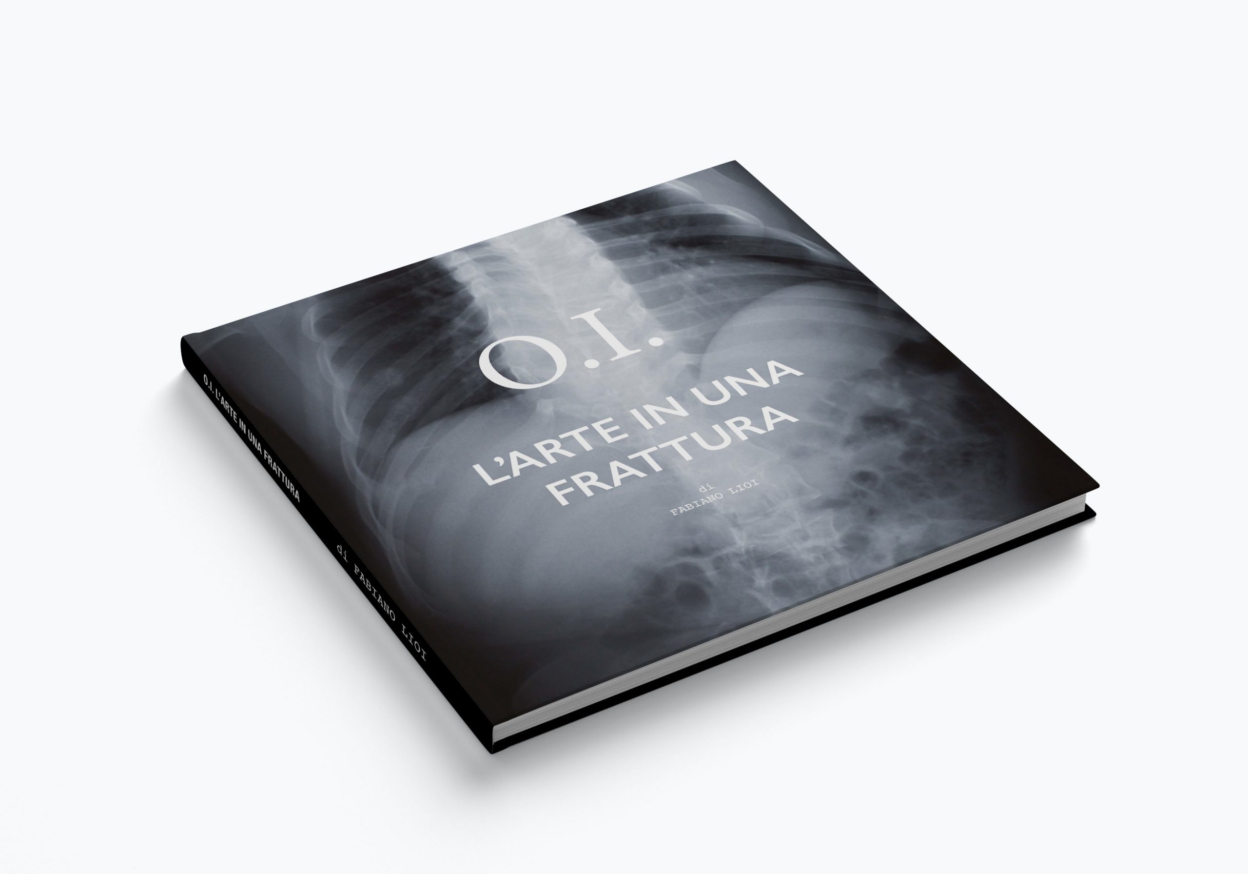 O.I. L'arte in una frattura: la copertina del libro sull'osteogenesi imperfetta